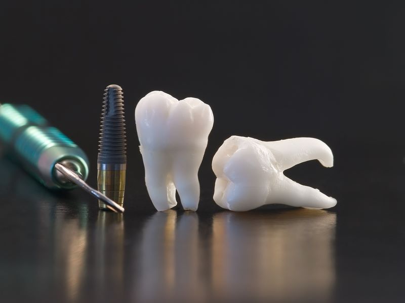 استیل 410 در تجهیزات دندانپزشکی